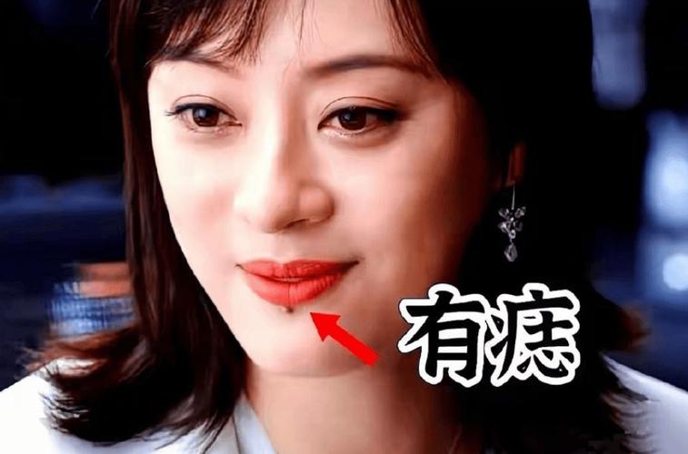 孙俪唇下痣没了,孙俪嘴唇的痣